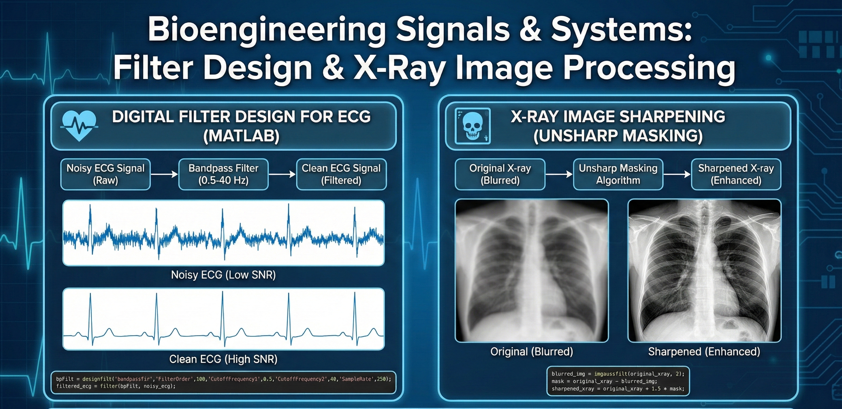 Bioengineering Signals & Systems: Filter Design & X-Ray Image Processing - Homework Answer and Solution