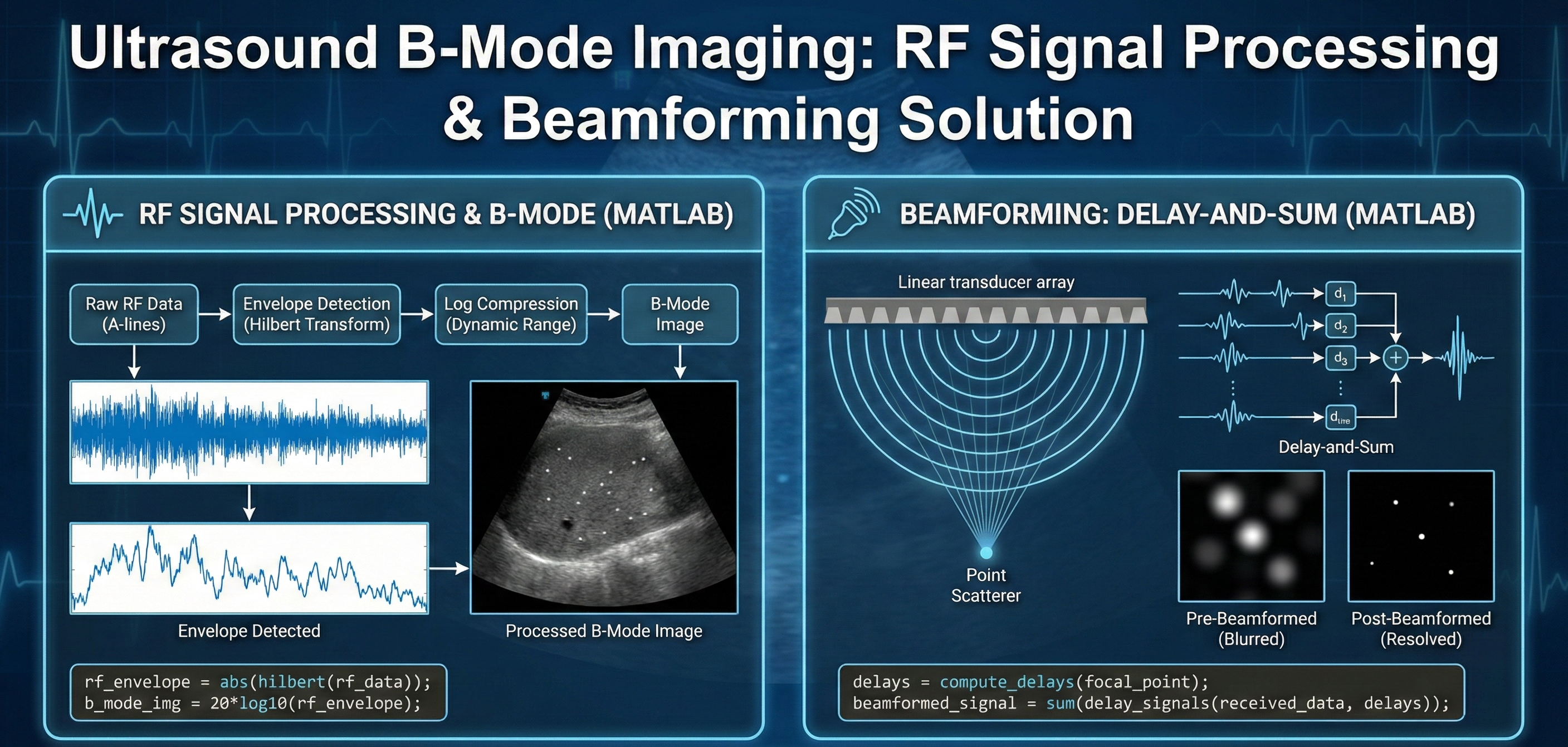 Ultrasound B-Mode Imaging: RF Signal Processing & Beamforming Solution - Homework Answer and Solution